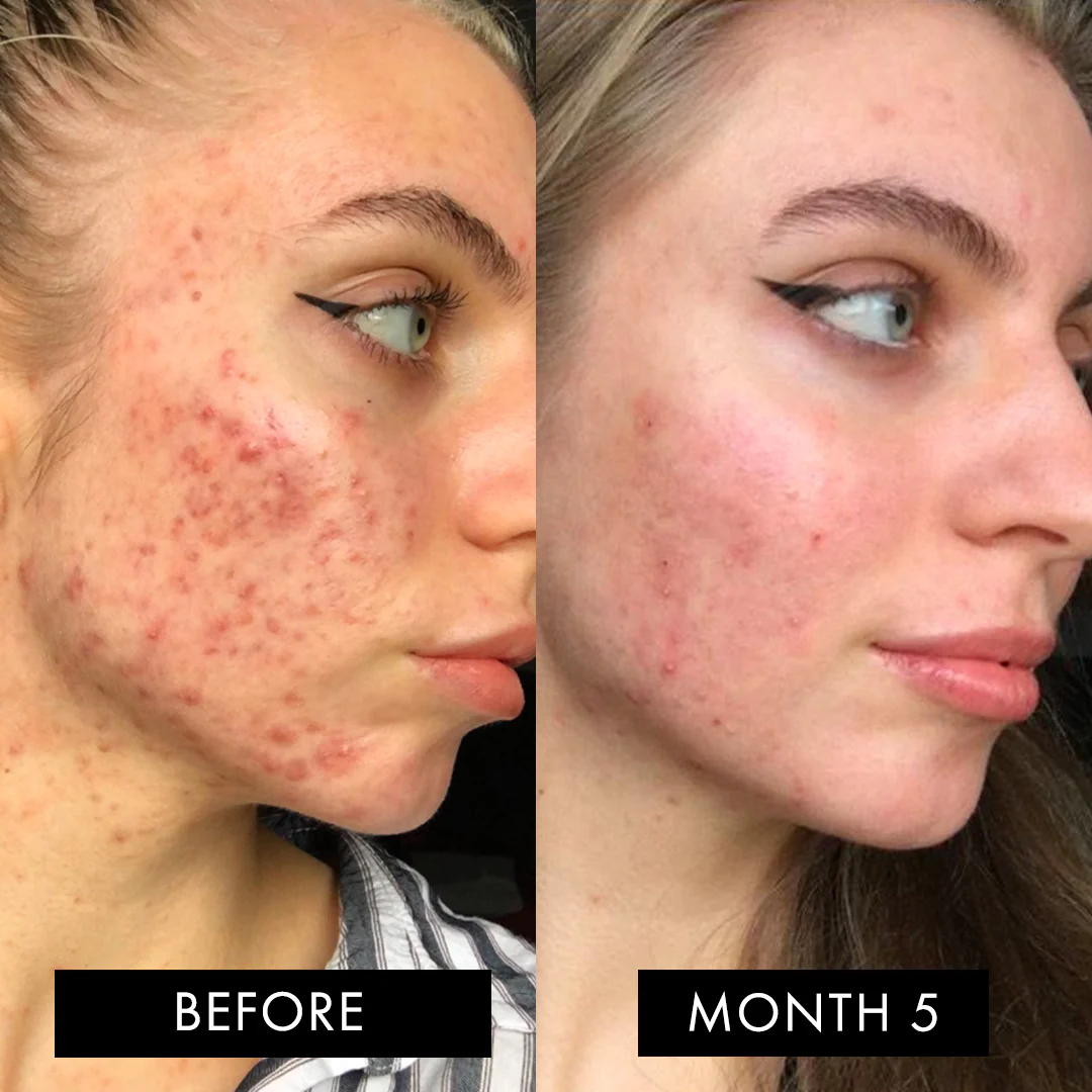 The Skin Elixir - Image 8