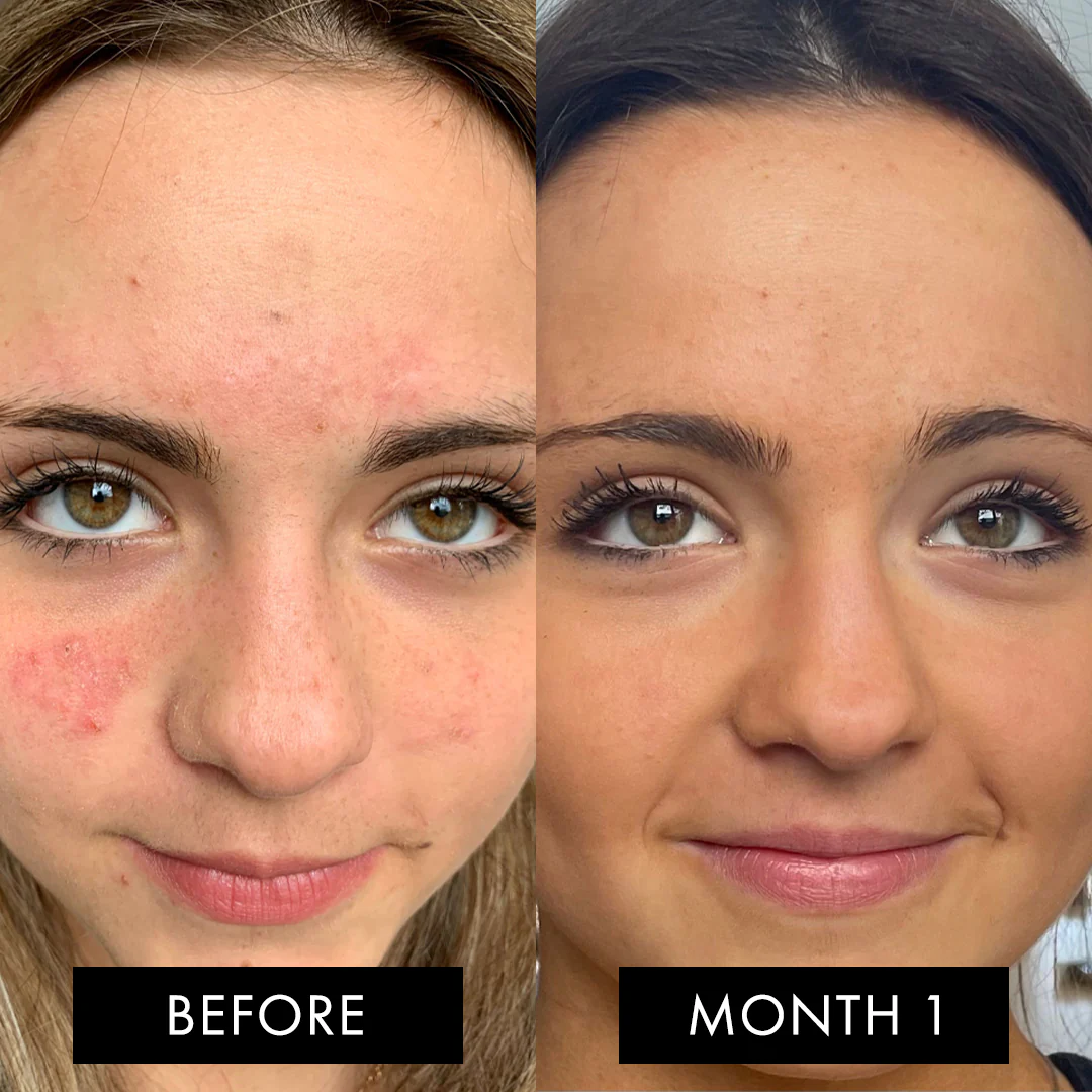 The Skin Elixir Three Month Pack - Image 9
